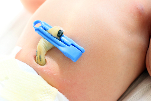 Comment soigner le cordon ombilical de bébé ?