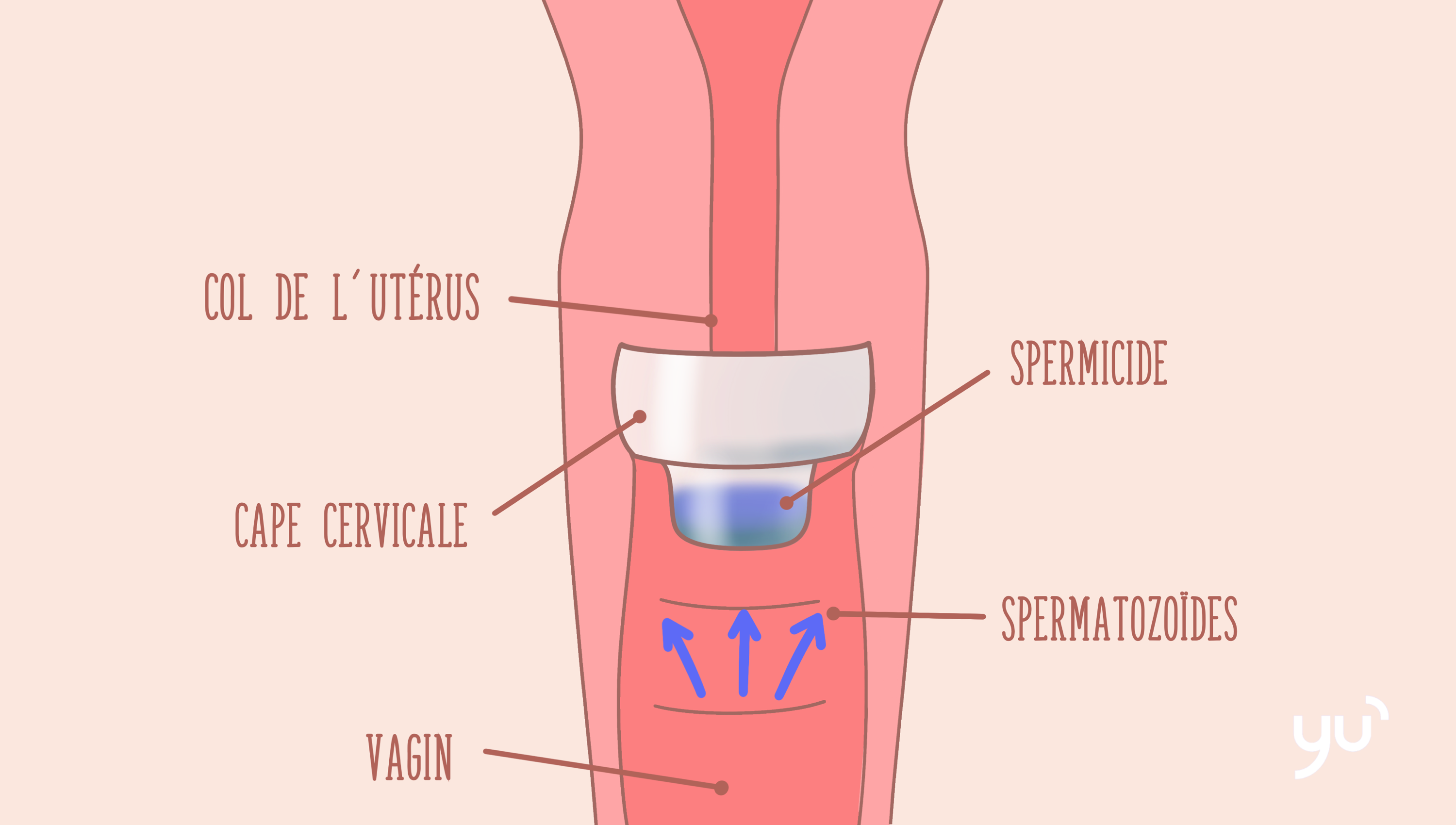 Guide pratique : comment utiliser la cape cervicale correctement