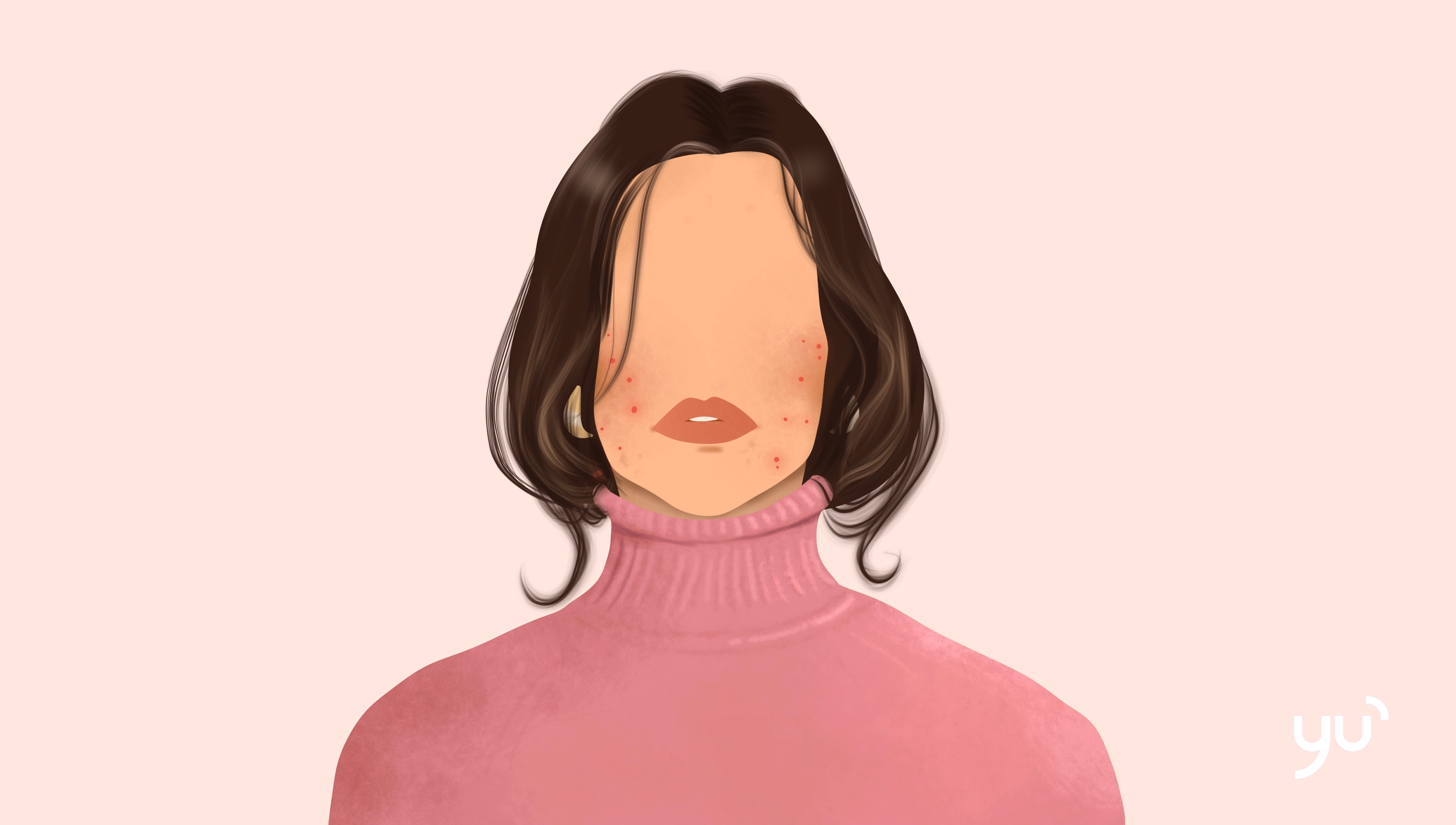 Comprendre les causes de l’acné : un guide complet