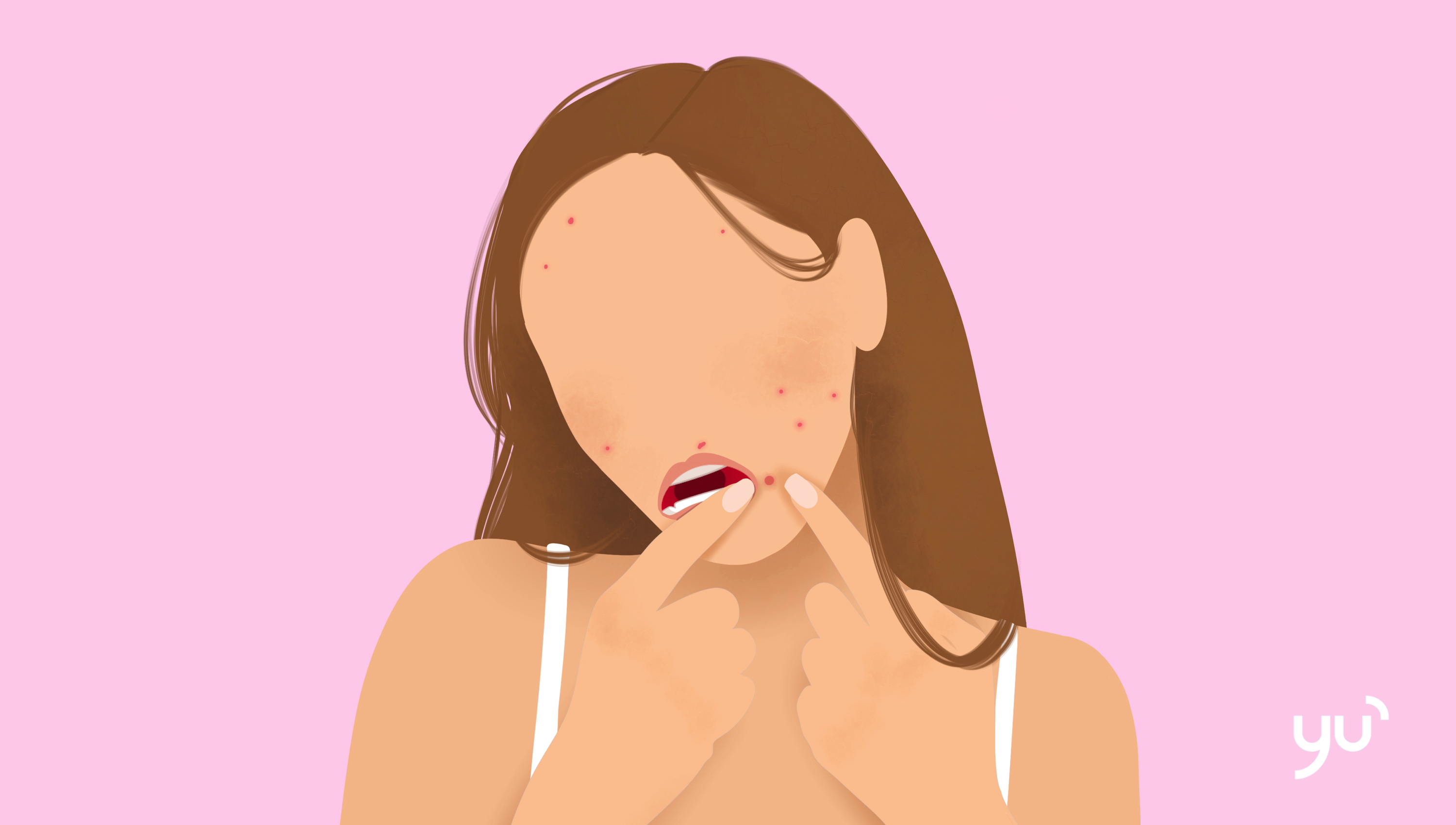 Pourquoi faut-il éviter de percer les boutons ?