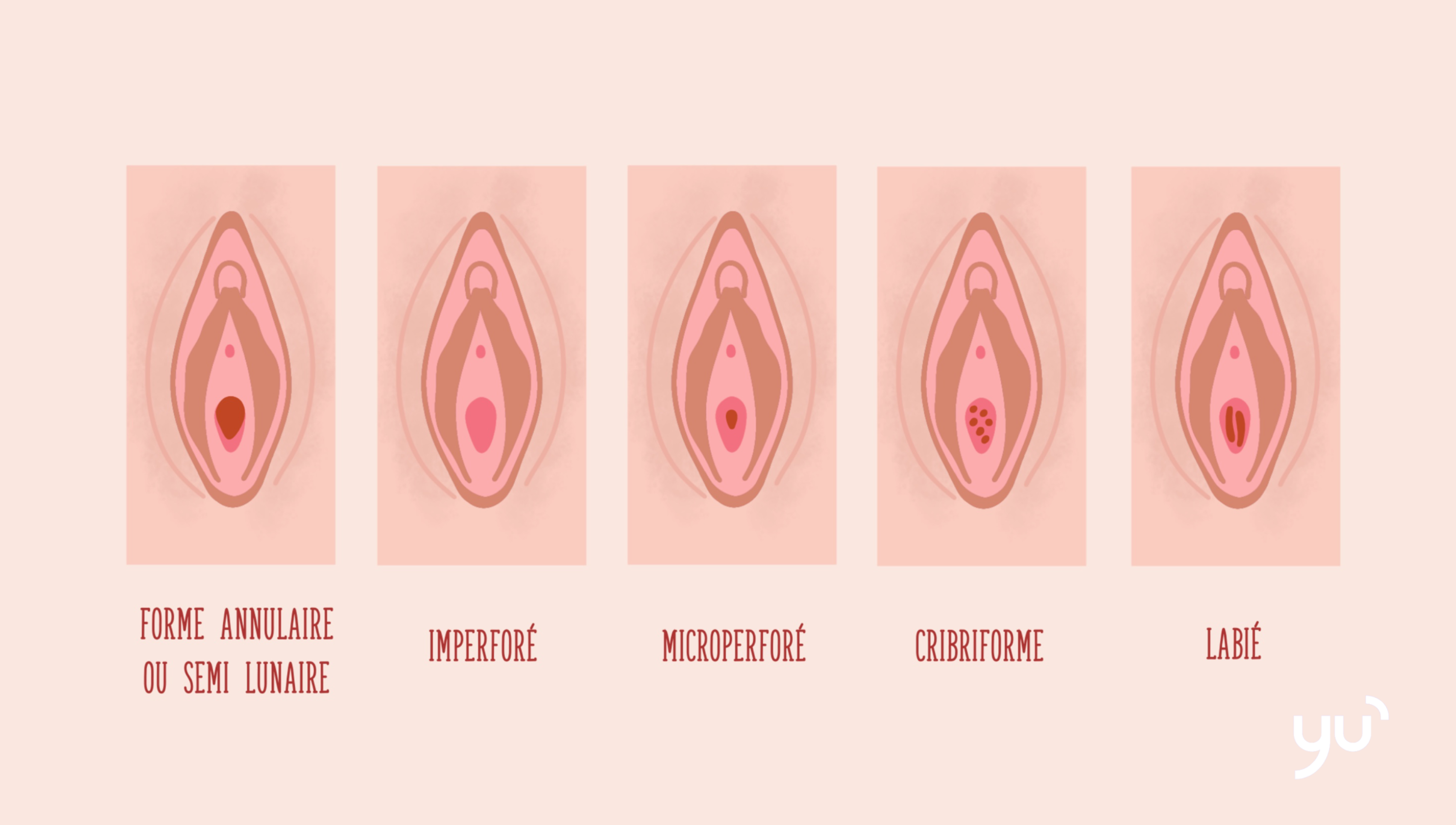 L’hymen : mythe et idées reçues