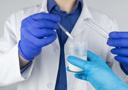 Tout ce que vous devez savoir sur la norme du liquide séminal et comment améliorer sa qualité