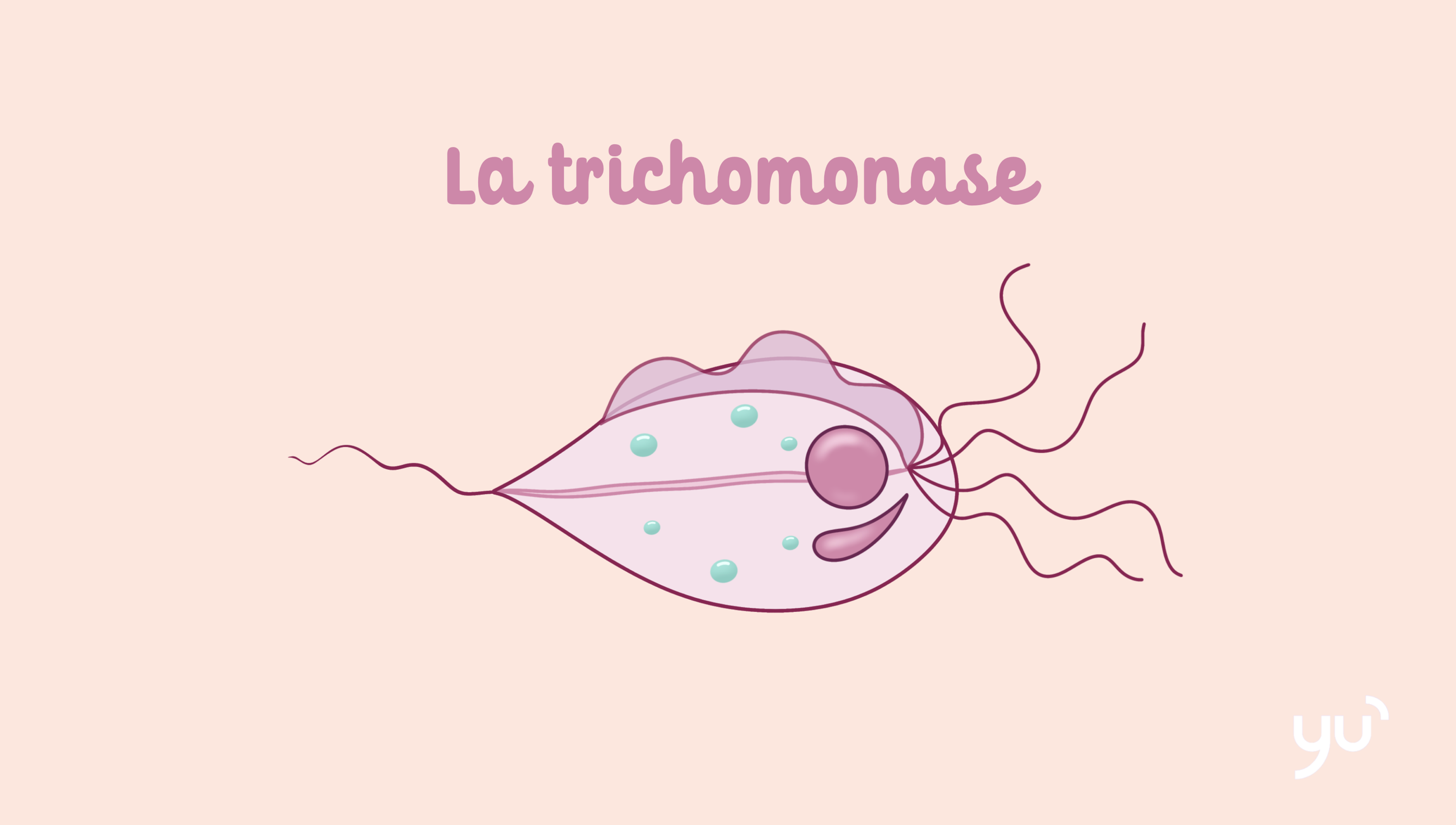La trichomonase : une infection sexuellement transmissible à connaître