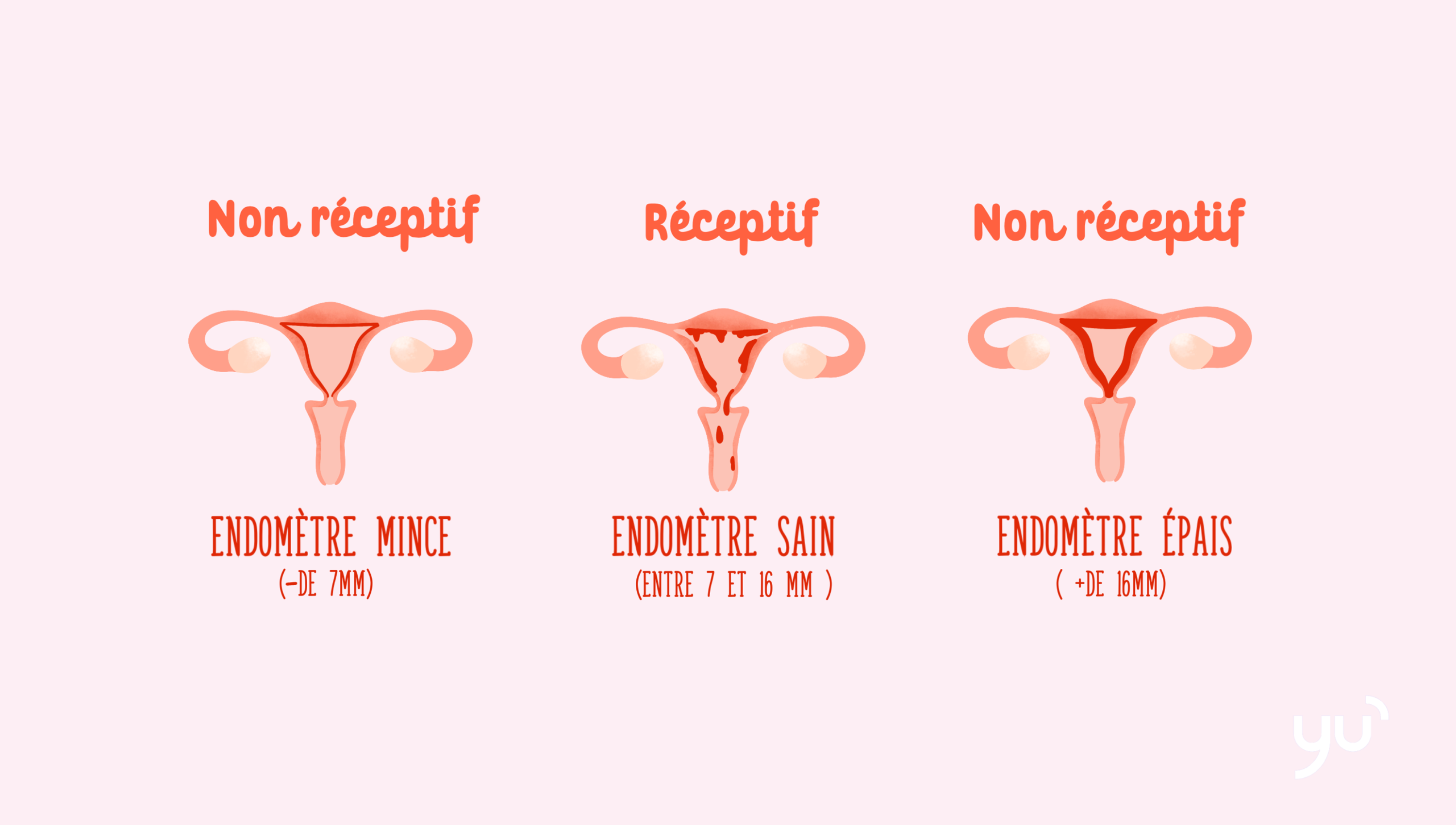 Comment l’état de l’endomètre affecte la fertilité