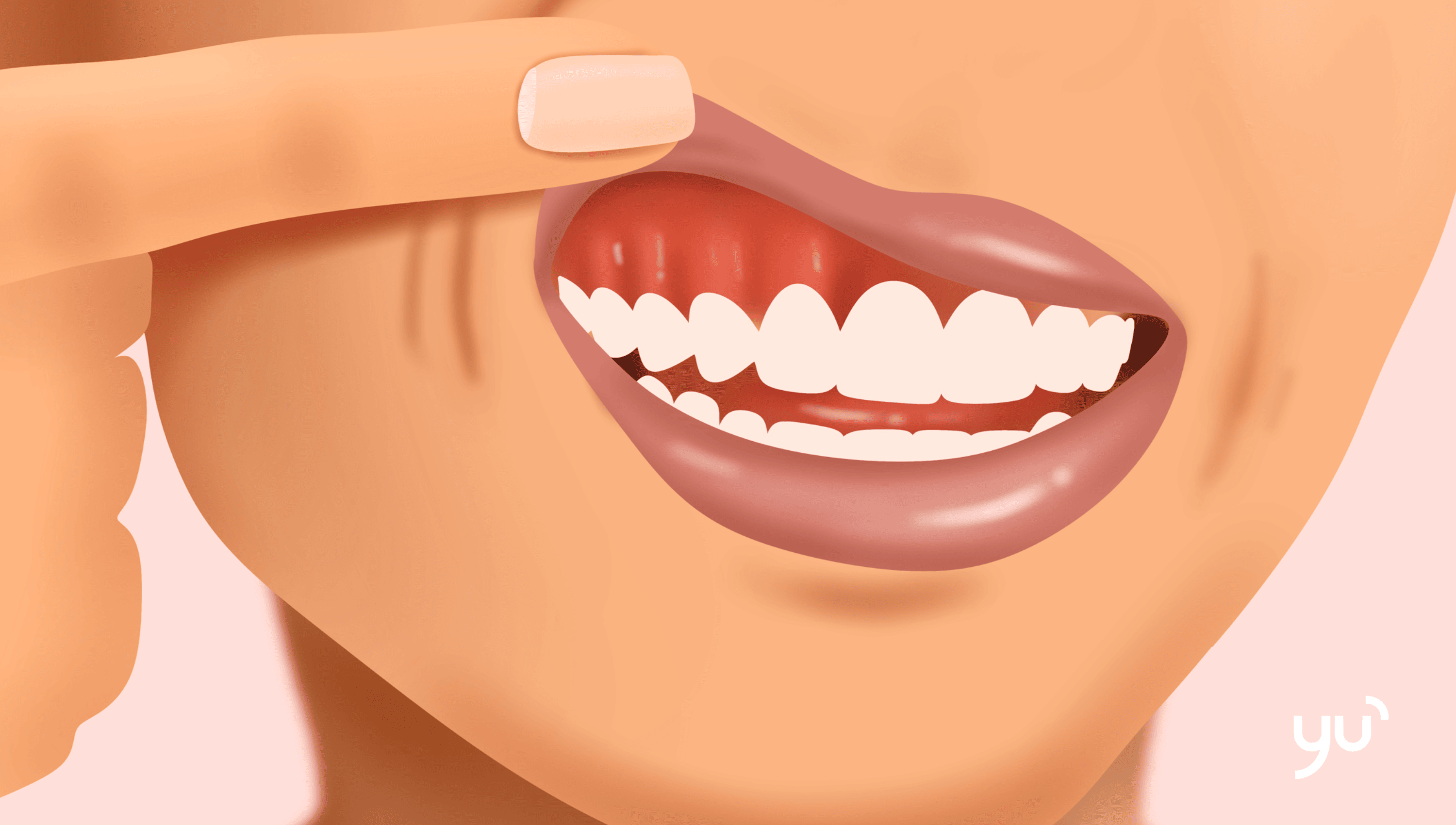 Pourquoi vos gencives vous font-elles mal pendant votre grossesse ?