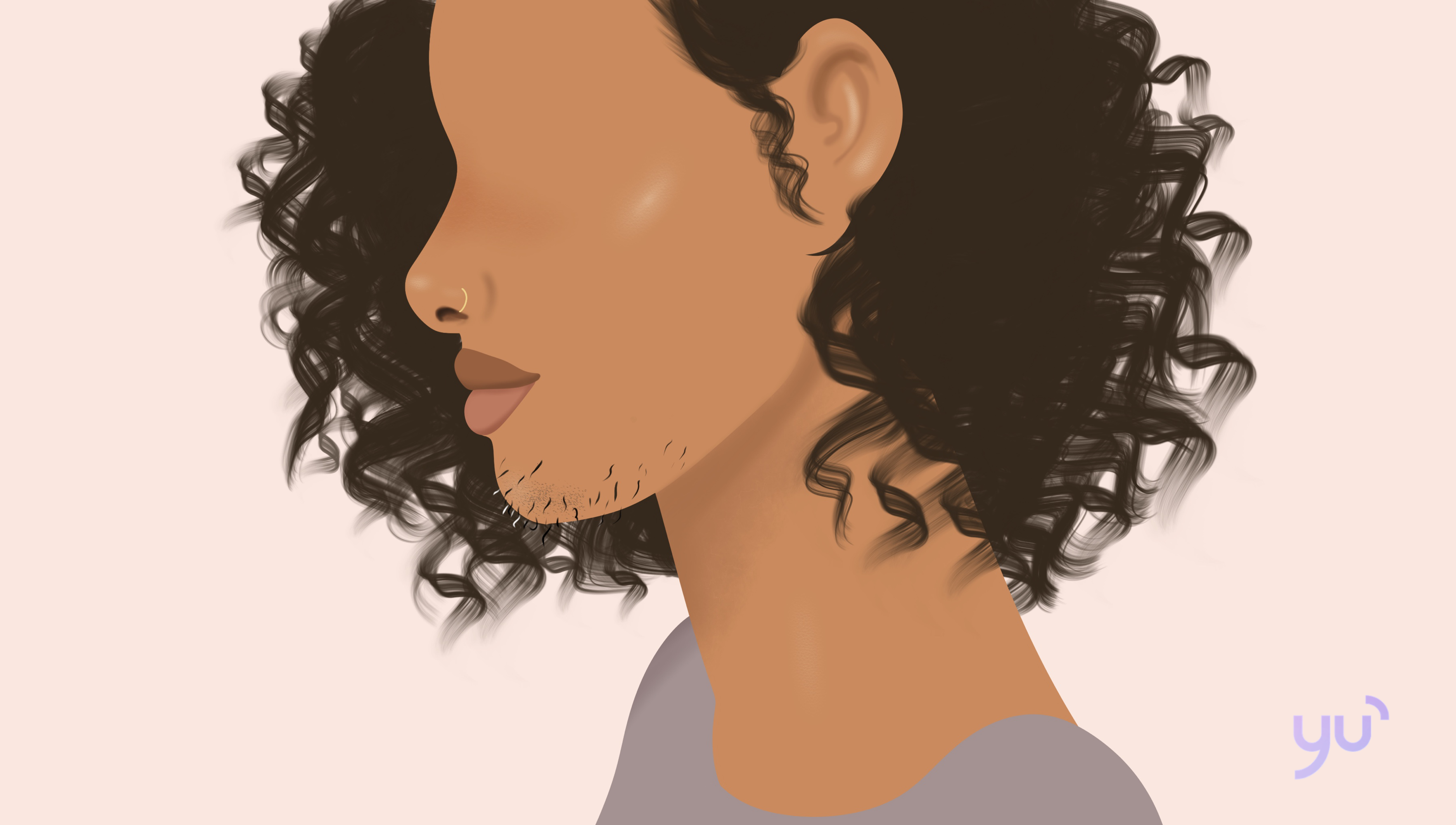 Hirsutisme : un symptôme courant du SOPK à ne pas négliger