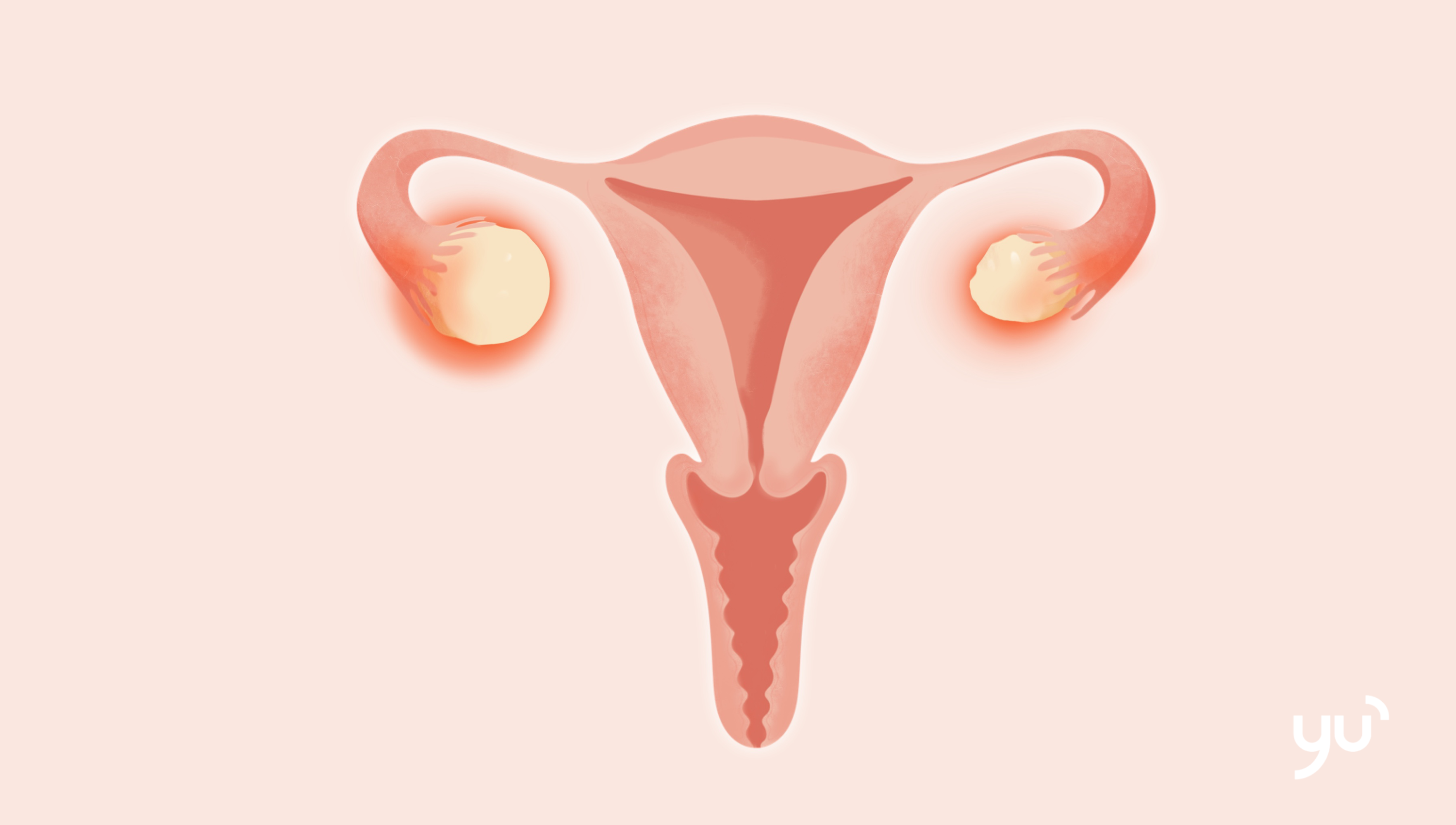 L’essentiel à savoir sur l’annexite
