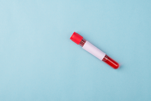 Tests génétiques prénataux : qui est concerné ?