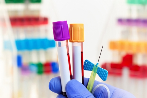 Pourquoi faire un test génétique avant de tomber enceinte ?