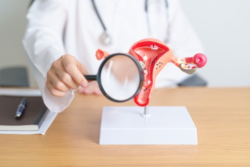 Comment vérifier la fonctionnalité des trompes de Fallope ?