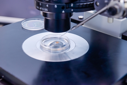 Qui a recours à la PMA et pourquoi ?