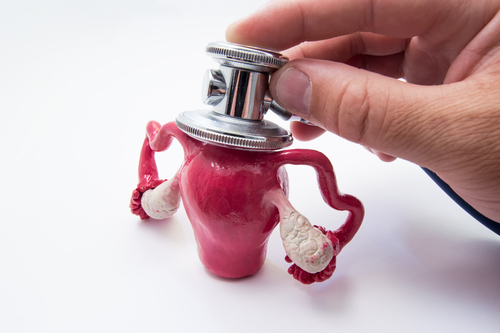 Comprendre la maladie inflammatoire pelvienne : causes, symptômes et traitements